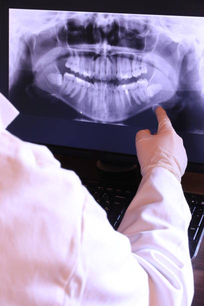 Best Emergency Dental Care for Broken or Chipped Teeth in Bonita, CA