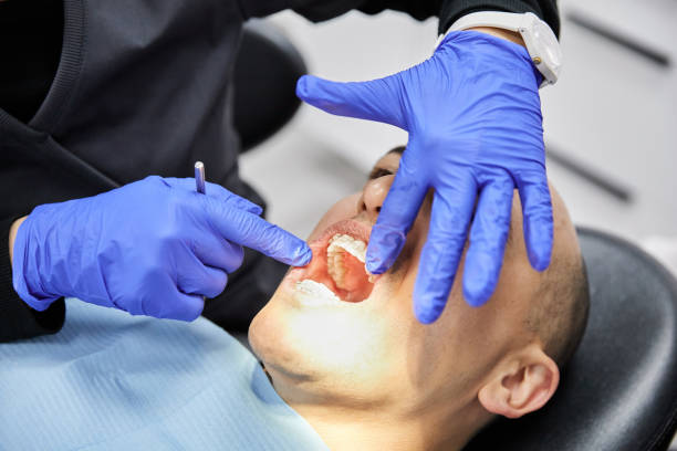 Best Emergency Gum Treatment in Bonita, CA
