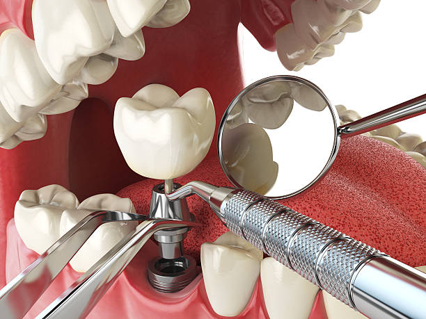 Best Cosmetic Emergency Dentistry in Bonita, CA
