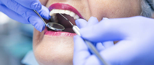 Best Emergency Dental Care for Broken or Chipped Teeth in Bonita, CA